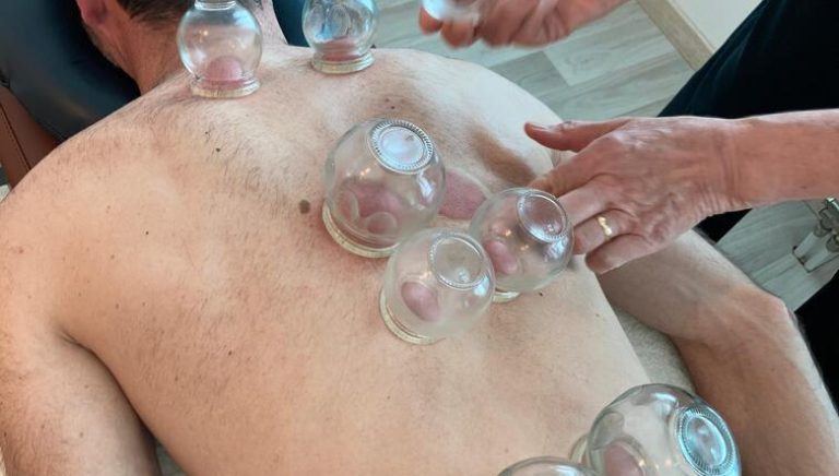 physio-praille-therapies-complementaires-geneve-lancy-ventouses1